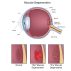 Macular Degeneration