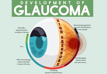 What is Glaucoma