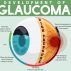 What is Glaucoma