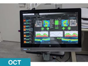 Optical Coherence Tomography